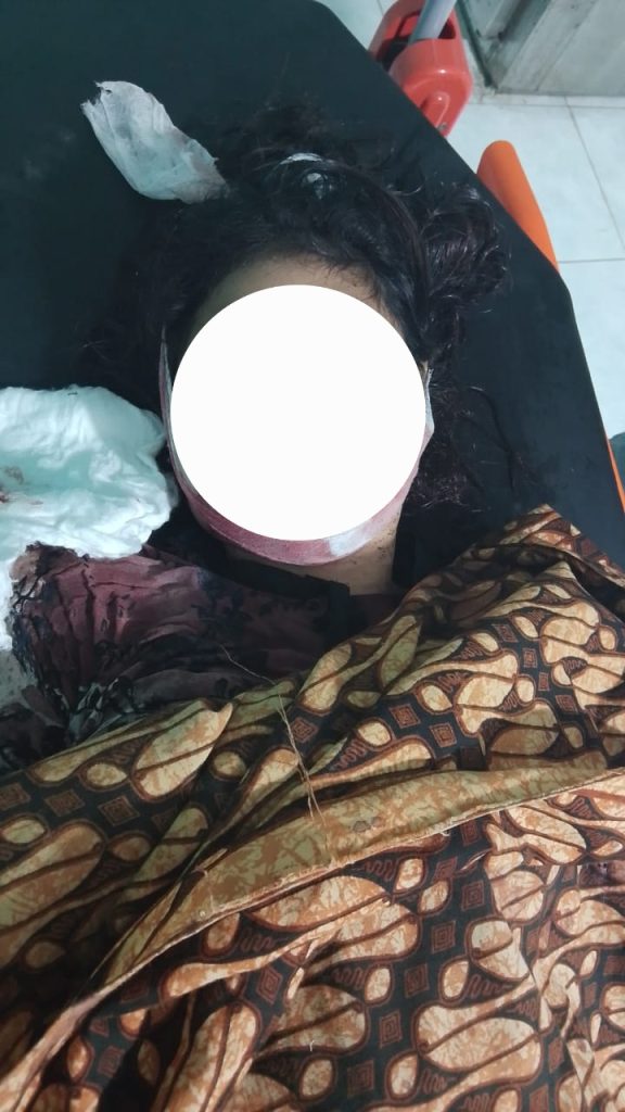 Kasat Reskrim Polres Sumbawa : Autopsi Jenazah Korban Pembunuhan Sadis DI Cafe Helena Menunggu Rekomendasi Bidokkes Polda NTB